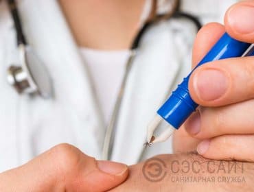 Снятие клеща специальным пинцетом Снятие клеща специальным пинцетом